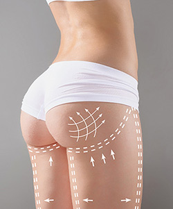Butt Contouring Near Me in Wappingers Falls, NY