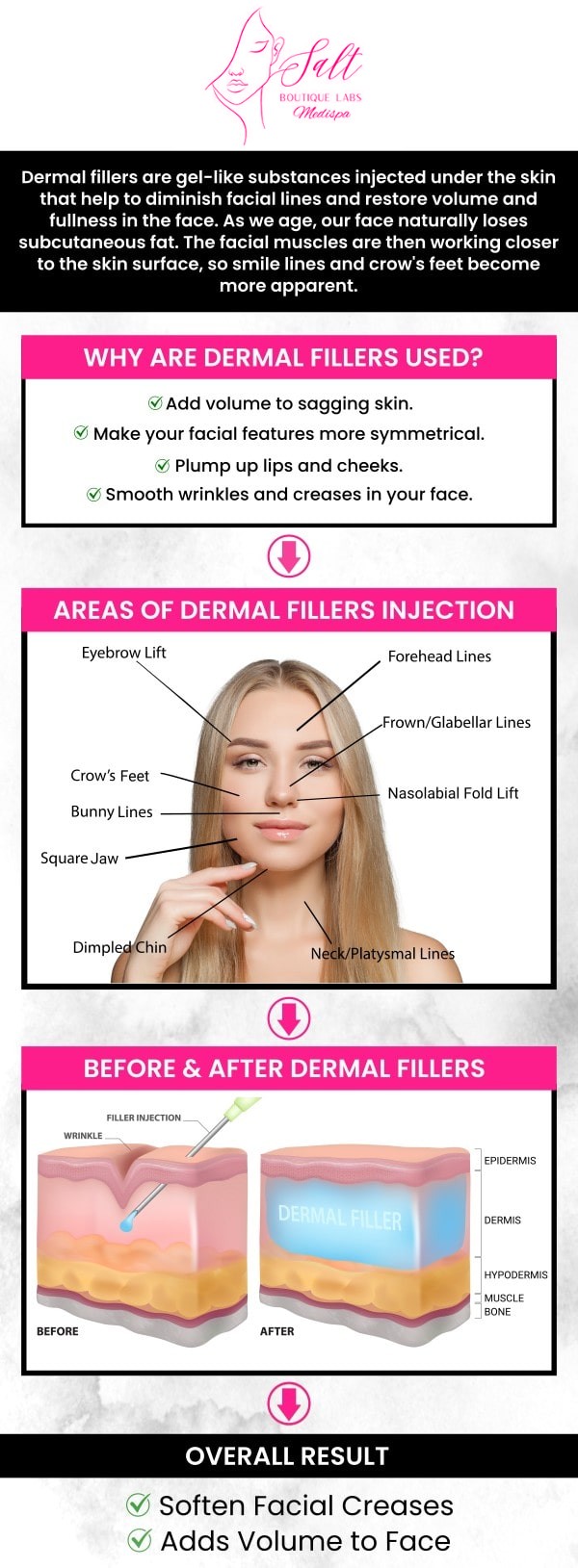 At Salt Boutique Labs, our experienced team, led by Dr. Reina Barrett-Baas, DNP, is committed to enhancing your natural beauty through personalized dermal filler treatments. Dr. Barrett-Baas carefully evaluates your unique facial structure, skin type, and aesthetic goals to deliver noticeable results. Using the latest techniques and premium-quality dermal fillers, we smooth fine lines, restore volume, and rejuvenate your appearance, prioritizing your comfort, safety, and satisfaction at every step. Our tailored treatments help you achieve a refreshed, youthful look that boosts confidence. For more information, feel free to contact us or book an appointment today! We are located at 70 East Main Street, Wappingers Falls, NY 12590.