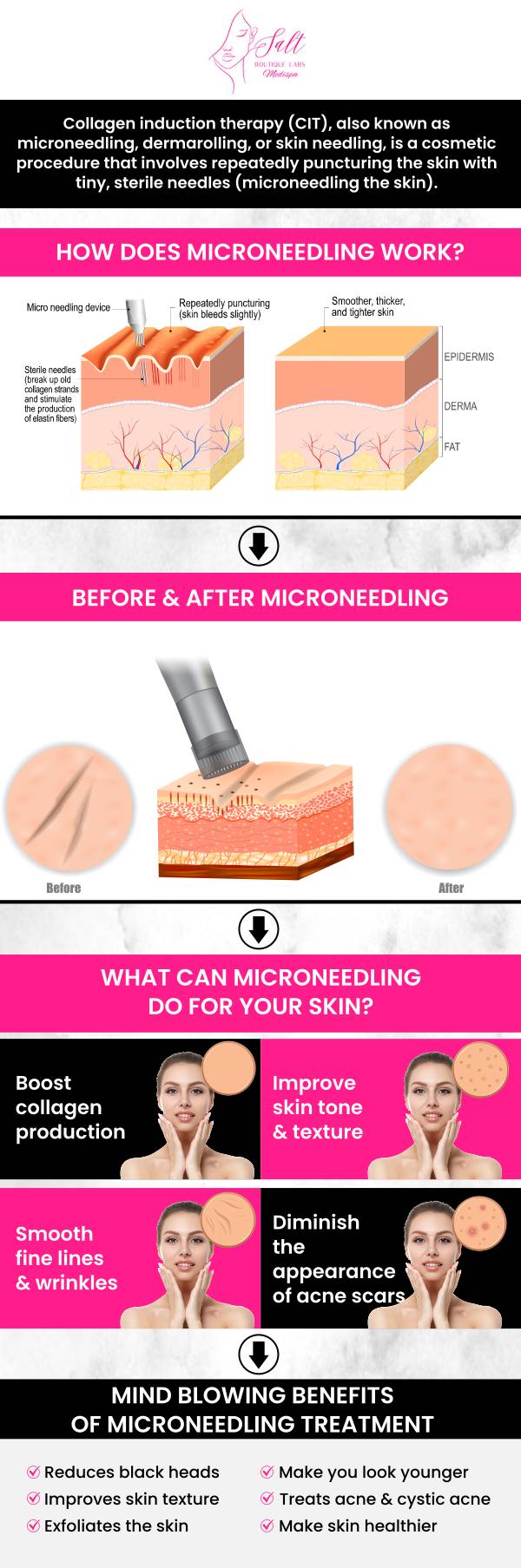 At Salt Boutique Labs, Dr. Reina Barrett-Baas, offers specialized microneedling with laser contouring treatments. This advanced combination therapy targets skin texture, tone, and elasticity, promoting collagen production and enhancing facial contours. Utilizing state-of-the-art technology, the procedure is designed to tighten and rejuvenate the skin, providing a non-invasive solution for clients seeking a refreshed appearance. For more information, feel free to contact us or book an appointment today. We are located at 70 East Main Street, Wappingers Falls, NY 12590. At Salt Boutique Labs, Dr. Reina Barrett-Baas, offers specialized microneedling with laser contouring treatments. This advanced combination therapy targets skin texture, tone, and elasticity, promoting collagen production and enhancing facial contours. Utilizing state-of-the-art technology, the procedure is designed to tighten and rejuvenate the skin, providing a non-invasive solution for clients seeking a refreshed appearance. For more information, feel free to contact us or book an appointment today. We are located at 70 East Main Street, Wappingers Falls, NY 12590.
