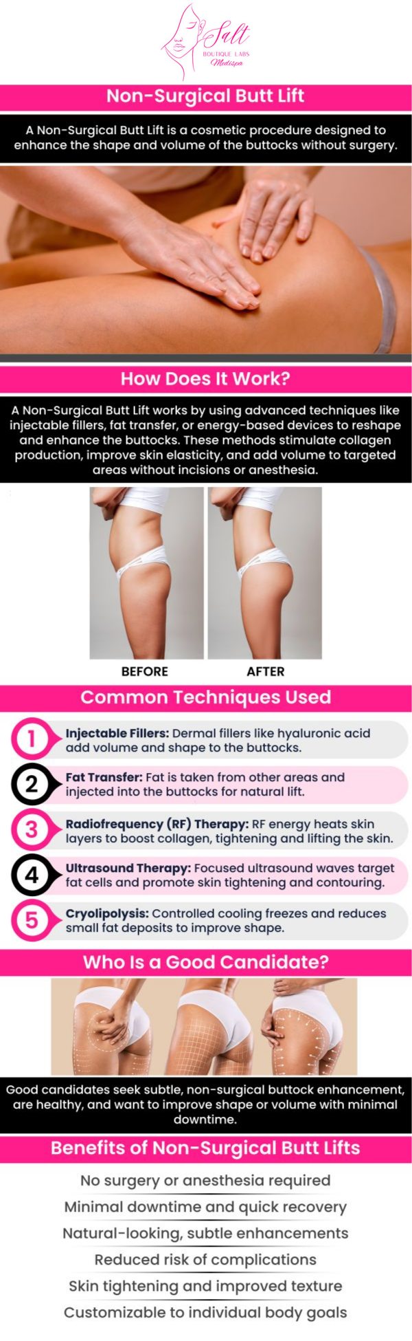 At Salt Boutique Labs, Dr. Reina Barrett-Baas, DNP, offers personalized buttocks treatments to enhance the shape, lift, and firmness of your buttocks. Using advanced, non-invasive techniques, Dr. Barrett-Baas helps you achieve a more contoured and youthful appearance, with minimal downtime and tailored solutions. For more information, please contact us today or request an appointment online. We are located at 70 East Main Street, Wappingers Falls, NY 12590.