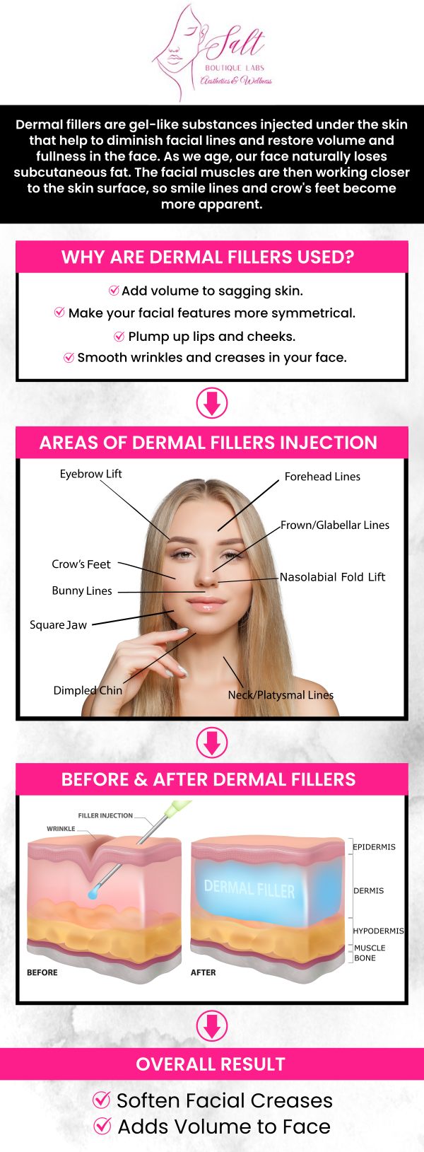 Reclaim your skin's natural fullness and enhance your profile contours with our premium, long-lasting hyaluronic acid fillers in the Hudson Valley. Directed by Dr. Reina Barrett-Baas, DNP, FNP-BC, our boutique clinic utilizes top-tier brands like Juvederm and Restylane to smoothly erase hollow under-eyes, define weak jawlines, and sculpt beautifully balanced, hydrated lips. Because we double as an advanced medical training hub, every treatment is delivered with the absolute highest level of anatomical safety, precision mapping, and artistic care to ensure your final results look soft, seamless, and entirely your own. For more information, please contact us today or request an appointment online. We are located at 70 East Main Street, Wappingers Falls, NY 12590.