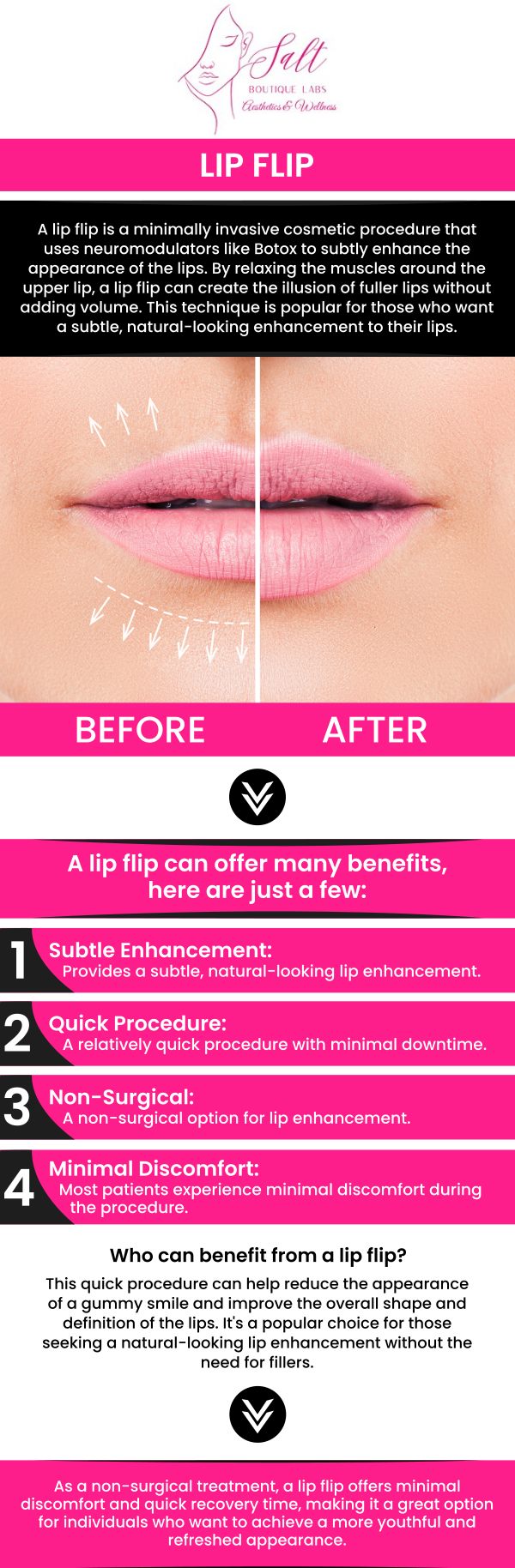 Looking for a Lip Flip specialist in Wappingers Falls, NY? Dr. Reina Barrett-Baas, DNP, at Salt Boutique Labs Aesthetic and Wellness offers expert lip enhancement treatments designed to create a subtle, natural-looking lift to your upper lip. The lip flip procedure uses Botox or similar injectables to enhance your smile without the need for fillers. For more information, please contact us today or request an appointment online. We are located at 70 East Main Street, Wappingers Falls, NY 12590. Looking for a Lip Flip specialist in Wappingers Falls, NY? Dr. Reina Barrett-Baas, DNP, at Salt Boutique Labs Aesthetic and Wellness offers expert lip enhancement treatments designed to create a subtle, natural-looking lift to your upper lip. The lip flip procedure uses Botox or similar injectables to enhance your smile without the need for fillers. For more information, please contact us today or request an appointment online. We are located at 70 East Main Street, Wappingers Falls, NY 12590.