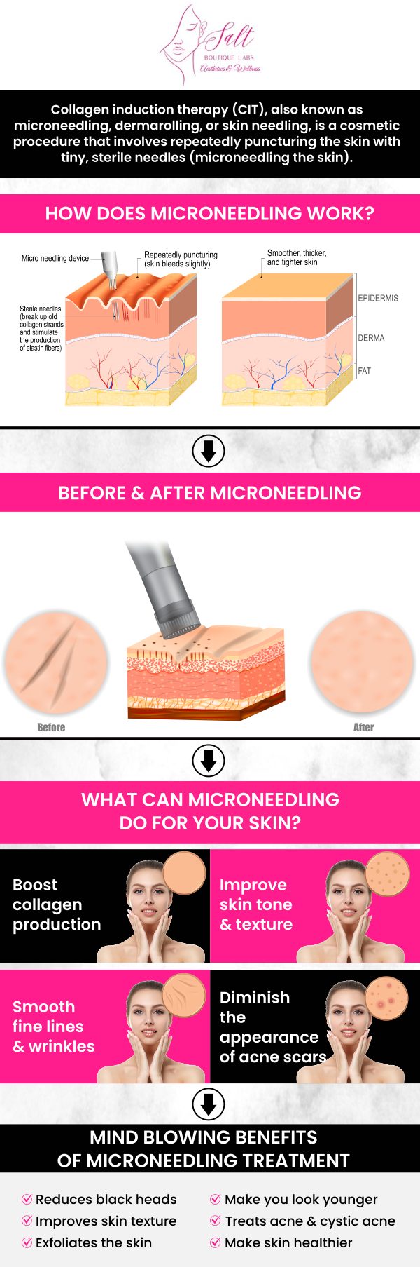 At Salt Boutique Labs Aesthetic and Wellness, we offer advanced PRP microneedling treatments to rejuvenate and revitalize your skin. Led by Dr. Reina Barrett-Baas, DNP, our team combines the power of platelet-rich plasma (PRP) with microneedling to stimulate collagen production and improve skin texture. This non-invasive procedure is designed to target fine lines, wrinkles, scars, and overall skin tone. For more information, please contact us today or request an appointment online. We are located at 70 East Main Street, Wappingers Falls, NY 12590. At Salt Boutique Labs Aesthetic and Wellness, we offer advanced PRP microneedling treatments to rejuvenate and revitalize your skin. Led by Dr. Reina Barrett-Baas, DNP, our team combines the power of platelet-rich plasma (PRP) with microneedling to stimulate collagen production and improve skin texture. This non-invasive procedure is designed to target fine lines, wrinkles, scars, and overall skin tone. For more information, please contact us today or request an appointment online. We are located at 70 East Main Street, Wappingers Falls, NY 12590.