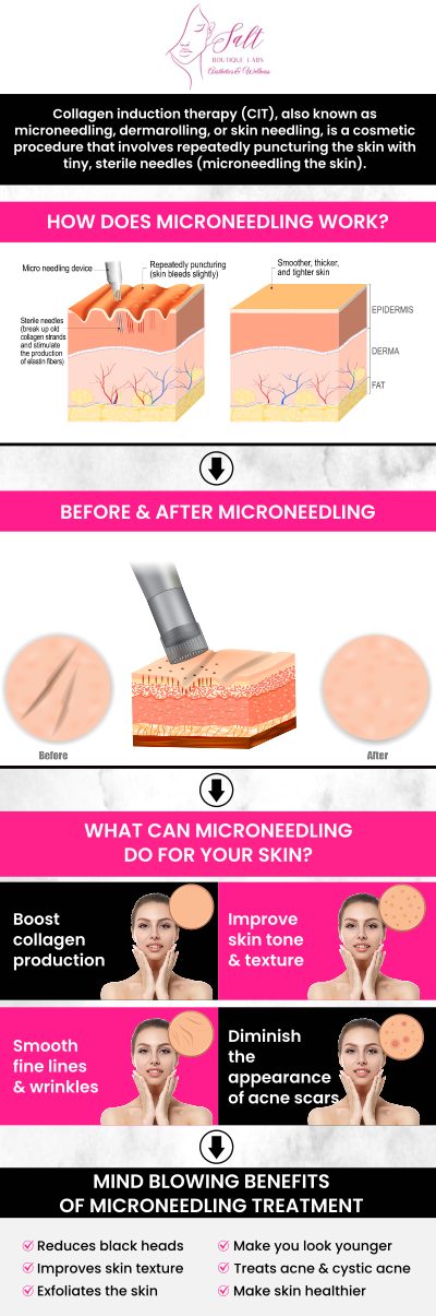 At Salt Boutique Labs, Dr. Reina Barrett-Baas, DNP, offers microneedling with growth factor treatments to promote skin rejuvenation, hair restoration, and healing. By utilizing the body’s natural growth factors, Dr. Barrett-Baas helps improve skin texture, reduce signs of aging, and enhance recovery from injuries. For more information, please contact us today or request an appointment online. We are located at 70 East Main Street, Wappingers Falls, NY 12590.