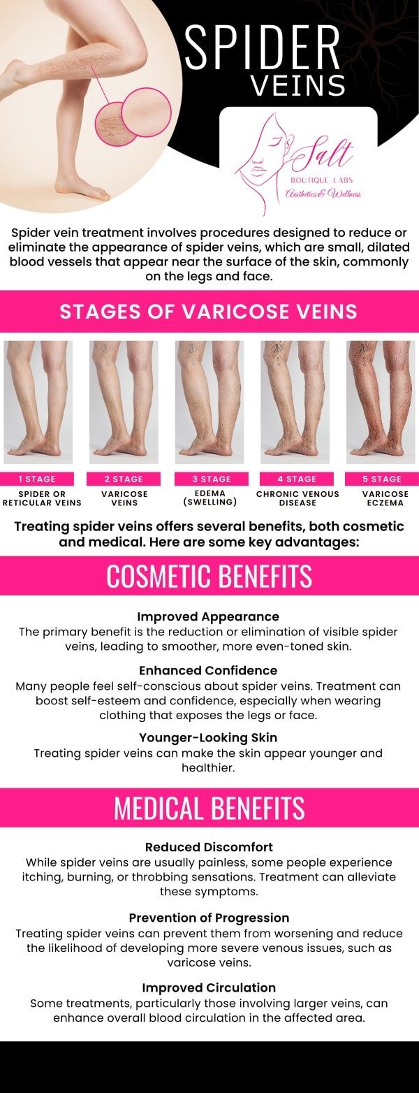 Common questions asked by clients: Is laser vein removal painful? How long does laser vein removal take? How much does laser vein removal cost? Does laser vein removal work permanently? How long does it take to see results from laser vein removal? How can Dr. Reina Barrett-Baas at Salt Boutique Labs Aesthetic and Wellness help me remove visible veins with laser vein removal? For more information, contact us or request an appointment online. We serve patients from Wappingers Falls NY, Spackenkill NY, Poughkeepsie NY, Beacon NY, Fishkill NY, East Fishkill NY, Rhinebeck NY, Millbrook NY, and surrounding areas.