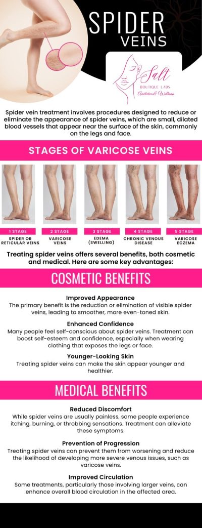 Common questions asked by clients: Is laser vein removal painful? How long does laser vein removal take? How much does laser vein removal cost? Does laser vein removal work permanently? How long does it take to see results from laser vein removal? How can Dr. Reina Barrett-Baas at Salt Boutique Labs Aesthetic and Wellness help me remove visible veins with laser vein removal? For more information, contact us or request an appointment online. We serve patients from Wappingers Falls NY, Spackenkill NY, Poughkeepsie NY, Beacon NY, Fishkill NY, East Fishkill NY, Rhinebeck NY, Millbrook NY, and surrounding areas.